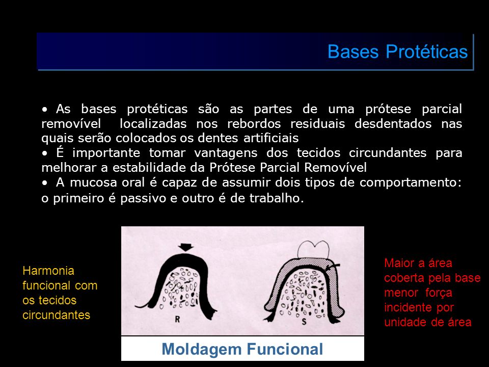 Bases Protéticas Moldagem Funcional